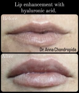 img 20230317 201029 521