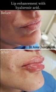 img 20230317 202323 816