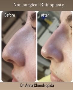 img 20230317 231428 909