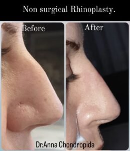 img 20230317 231549 136