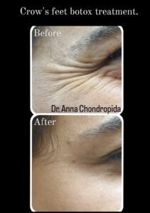 img 20230317 231859 960