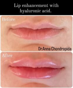 img 20230317 232451 452