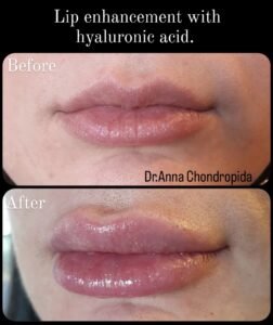 img 20230317 232723 776