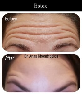 img 20230317 233204 076