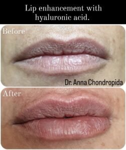 img 20230317 233340 644