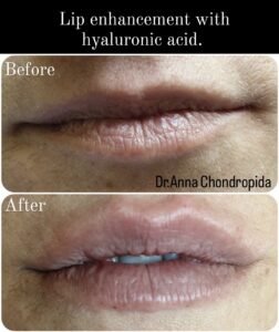 img 20230317 233447 015