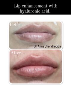 img 20230317 234556 080