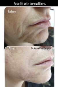 img 20230317 234845 151