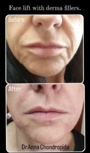 img 20230317 235028 613