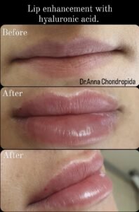 img 20230317 235214 640