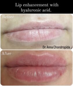 img 20230318 003428 686