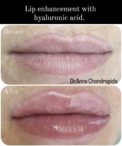 img 20230318 003533 457