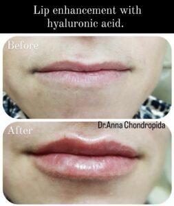 img 20230318 003635 999