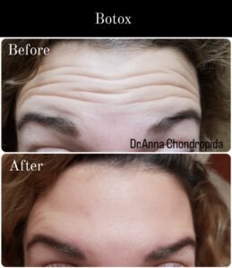 img 20230318 003815 713