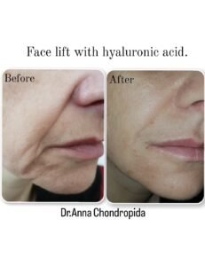 img 20230318 004153 200