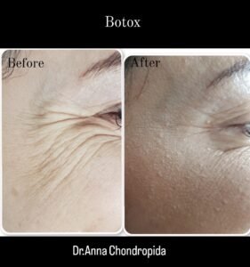 img 20230318 004430 218