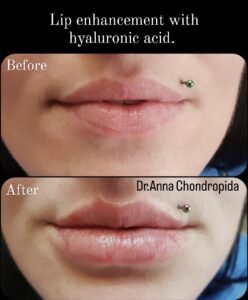 img 20230318 004525 262