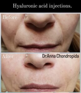 img 20230318 004759 387