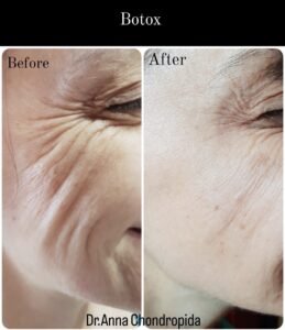 img 20230318 005435 836