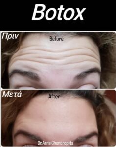 img 20230318 005636 918